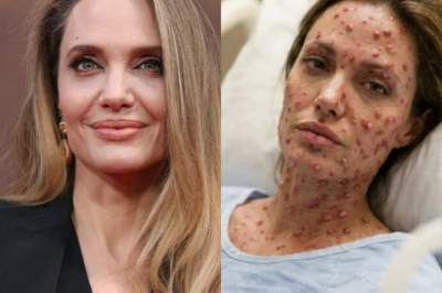 HEARTBREAKING NEWS: Angelina Jolie Taken to Hospital With a “Critical” Condition — Surgeons Grant They’ve Never Noticed a Case Like This Before…