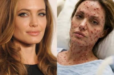 HEARTBREAKING NEWS: Angelina Jolie Driven to Hospital With a “Violent” Ailment — Experts Accept They’ve Never Witnessed a Case Like This Before… 😭