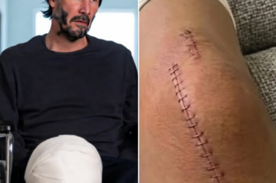 Keanu Reeves Breaks His Silence After Surgery — And What He Revealed Left Hollywood Speechless